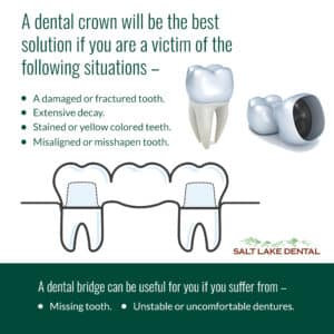 Dental bridge and crown