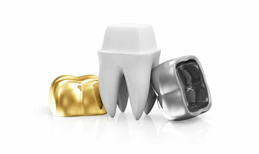 Cost of dental crowns salt lake dental