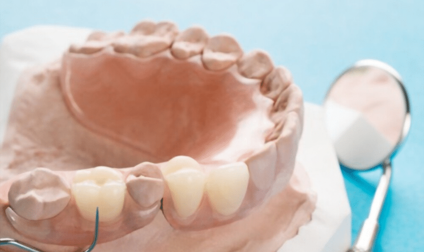 partial dentures