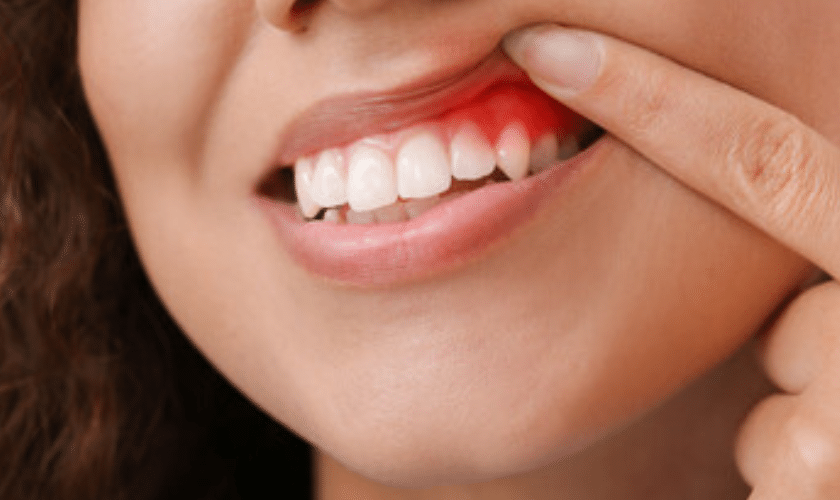 Tips to Keep Your Gum Healthy