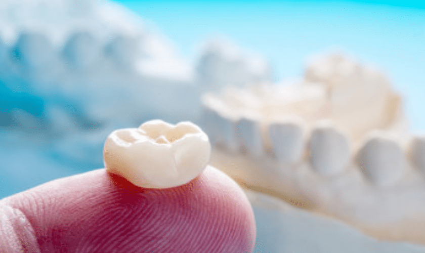 How to Properly Take Care of a Dental Crown