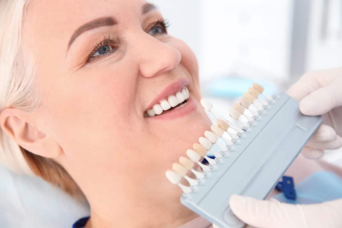Veneers in South Salt Lake