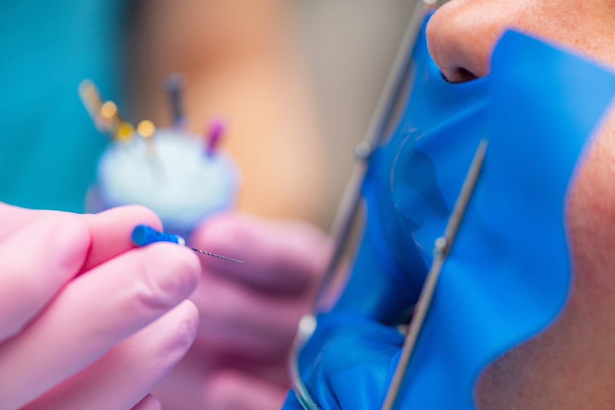 Root Canal Treatment in Salt Lake City